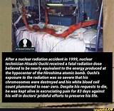 Hisashi Ouchi's Skin: a Devastating Nuclear Accident's Progression