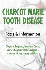 Marie Drummond Diagnosis: Understanding the Complexities